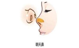 朝天鼻好不好,你需要了解的面相秘密