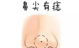 鼻尖有痣到底啥意思？你可能想不到的财运玄机