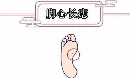 脚心有痣代表什么？命运、财富与运势详解