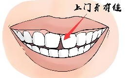 男人牙齿缝隙大，财运与感情运势如何