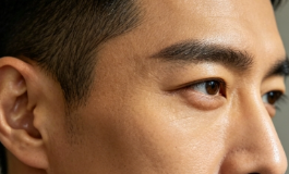 太阳穴凹陷为什么说多半是苦命相