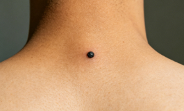 脖子后面有痣，是享福还是劳碌命